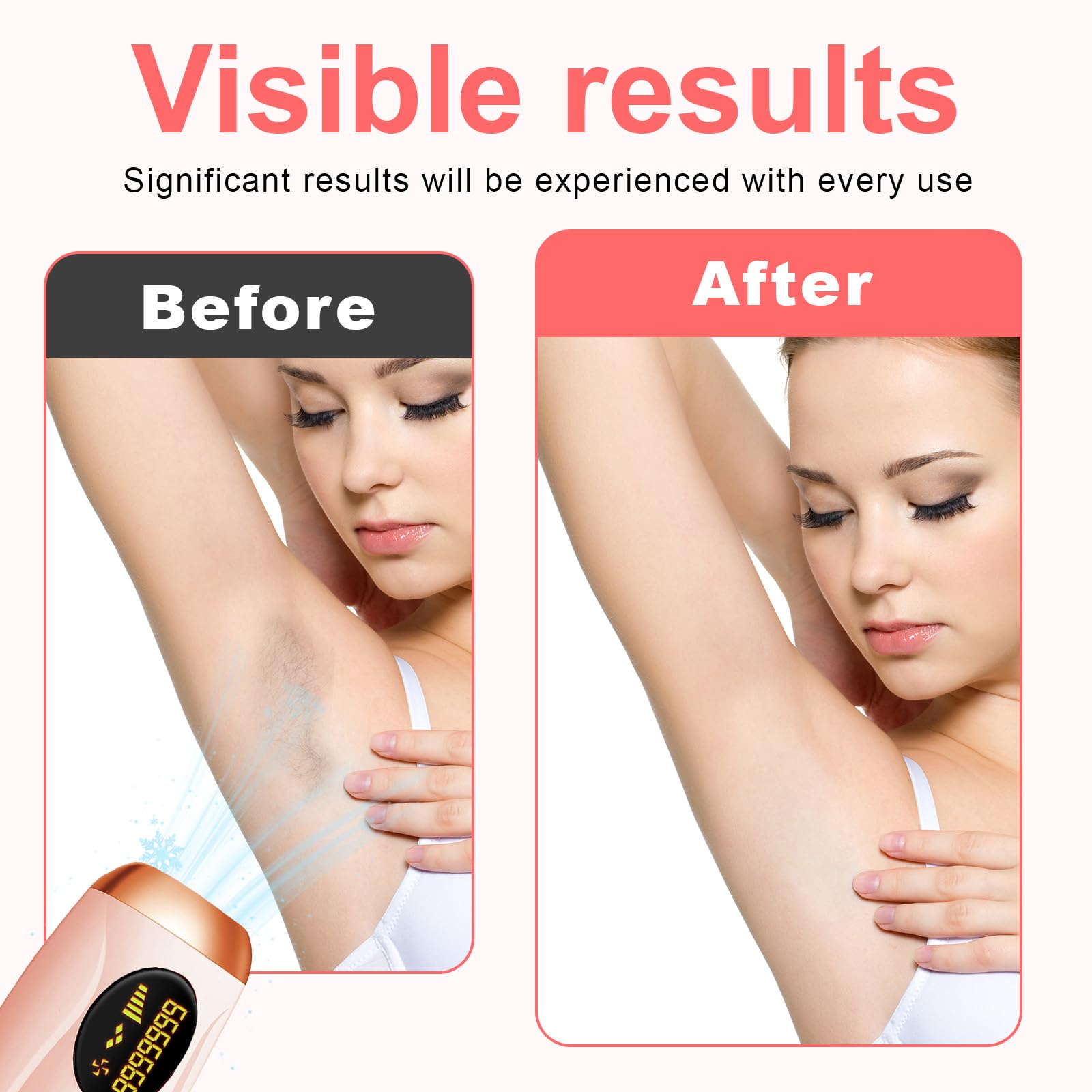 Epilatore Luce Pulsata,IPL Epilatore Laser Peli per Donna e uomo, 5 Livelli di Energia, 990.000 Flash, adatto per Donna e Uomo Viso, Ascelle, Gambe e Corpo