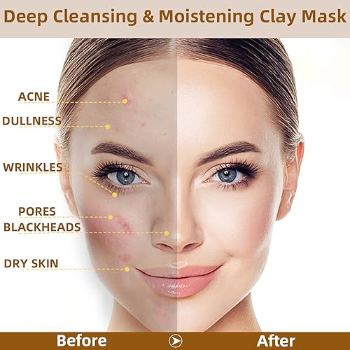 Miniatura 5 de NewBang Máscara de arcilla de vitamina C de cúrcuma máscara facial para el cuidado de la piel para manchas oscuras limpieza profunda de poros reduce