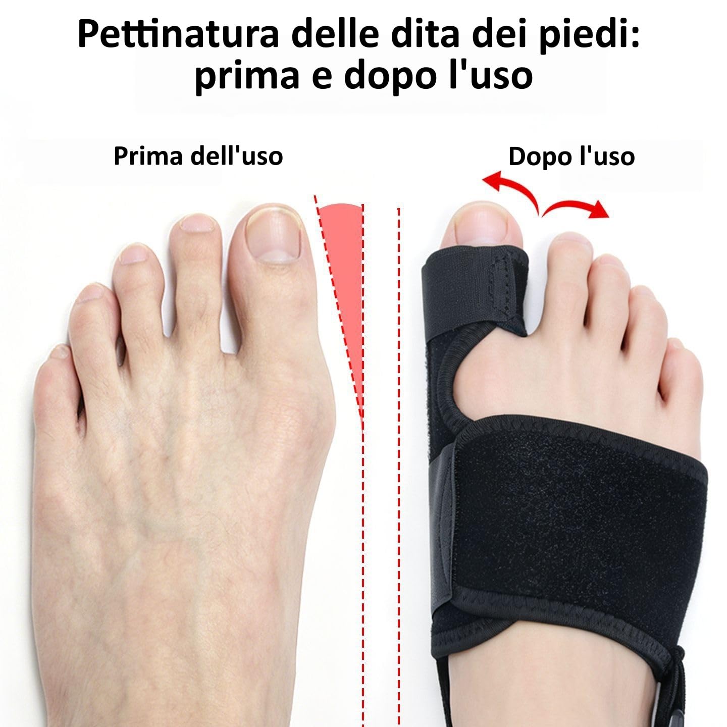 MEIION Karmor,Ortesi regolabile per l'alluce valgo,unisex,comoda