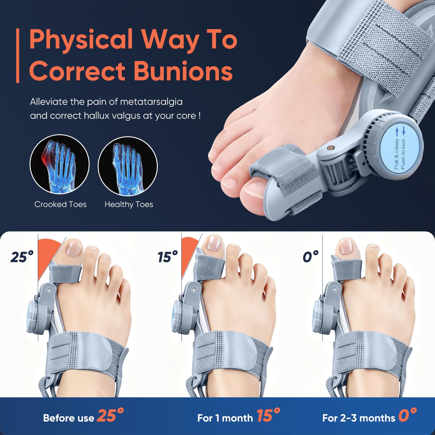 Bunion Corrector for Women & Men, Adjustable Knob Dual-Action Bunion Splint with Silicone Pad - Orthopedic Toe Straightener & Separator for Hallux Valgus Relief, Fits Left/Right Feet (Gray)