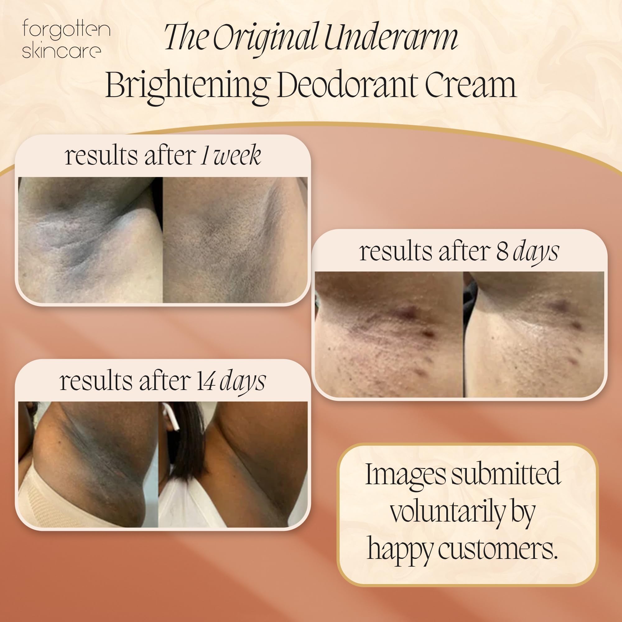 Crema schiarente e deodorante per ascelle, crema scurente e riparatrice per i genitali, lozione idratante per la cura delle ascelle, uniforma il tono della pelle, adatta a tutti i tipi di pelle