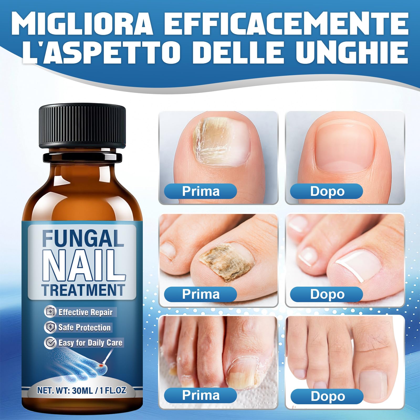 Micosi Unghie Piede, 30ml Liquido Antimicotico Unghie Piedi, Efficace Funghi Unghie Piedi con Pennello e Lima per Unghie Spesse, Ingiallite, Opache o Danneggiate