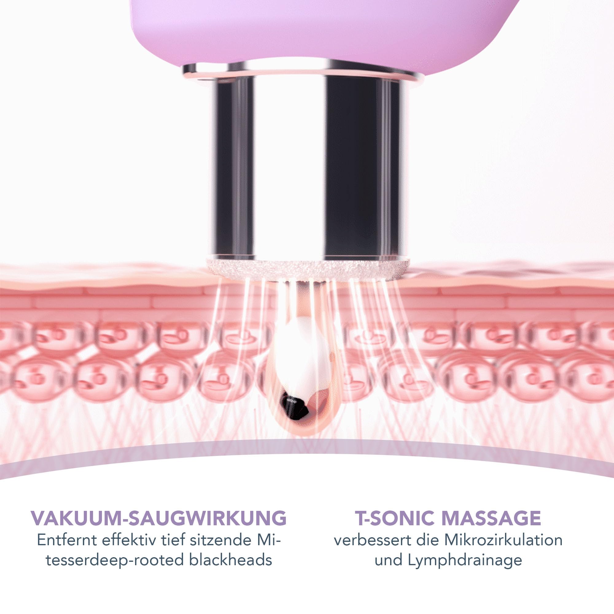 FOREO Smooth & Resurface KIWI derma Mikrodermabrasionsgerät - Mitesserentferner fürs Gesicht + KIWI™ Active Pore & Blackhead Maske, 100 g - Mitesserentferner - Tschüss-Poren-Strips-Porensauger