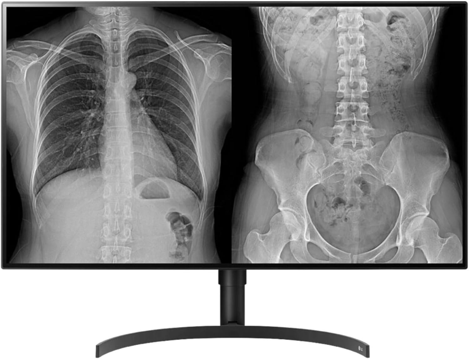 LG 32HL512D-B 31.5" 4K LCD Monitor - 16:9 - TAA Compliant