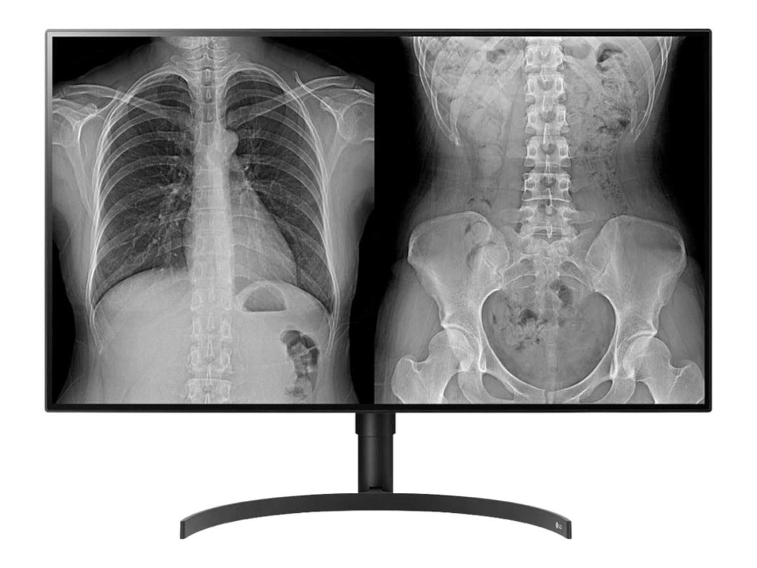 LG 32HL512D-B 31 5 4K LCD Monitor - 16 9 - TAA Compliant