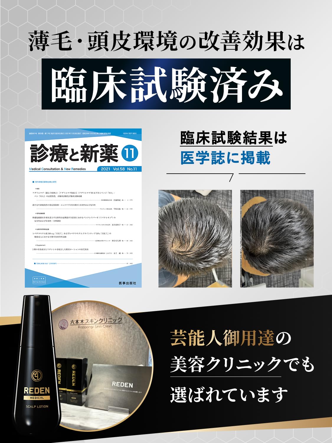 Amazon | 医薬部外品 REDENリデン 育毛剤 男女兼用 (2本セット