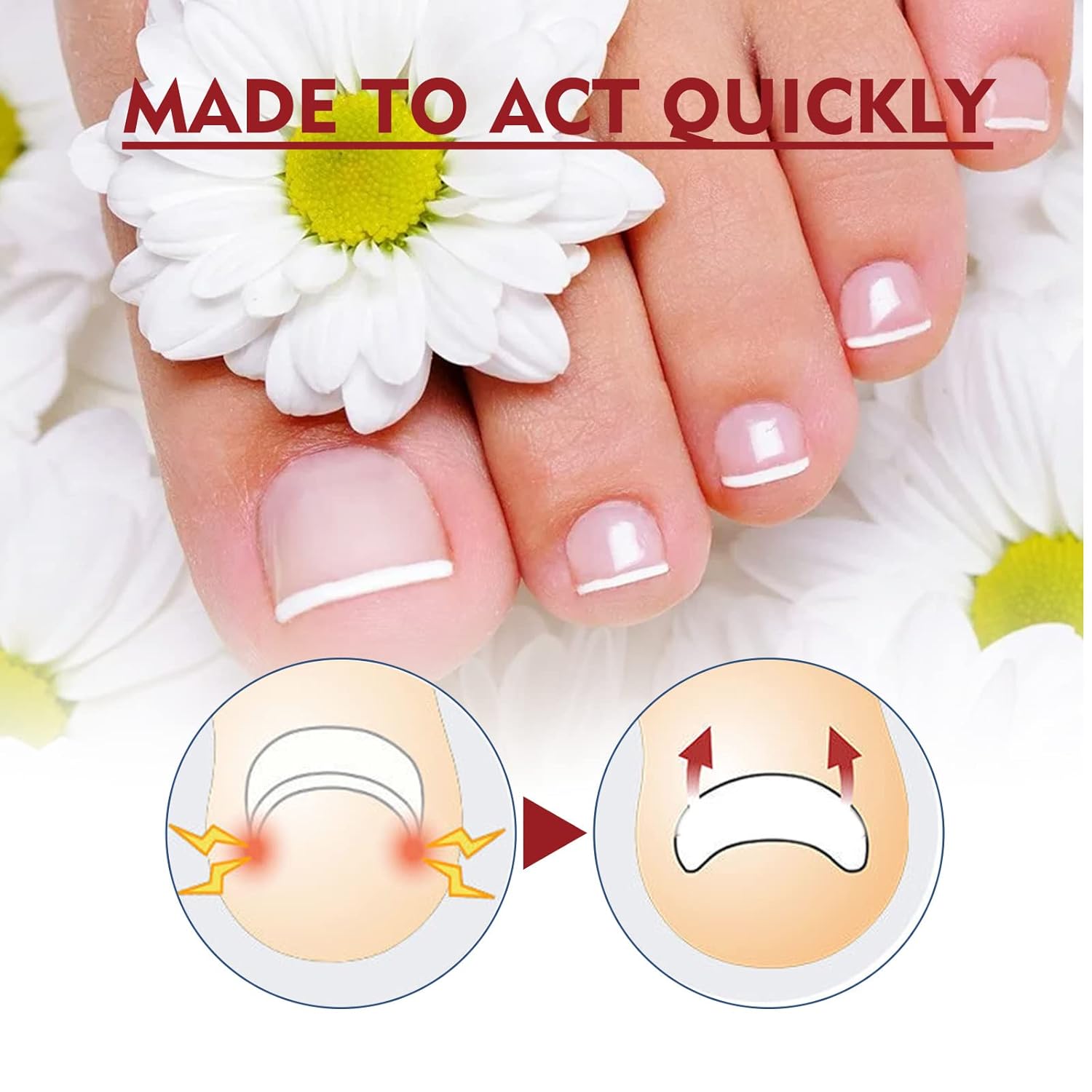 German Toenail Plus Anti Paronychia Relief Oil, German 2024 New Toenailplus™ Anti Paronychia Relief Oil, Anti Paronychia Relief Oil for Toenail Care, Best Nail Repair Solution (5PCS)