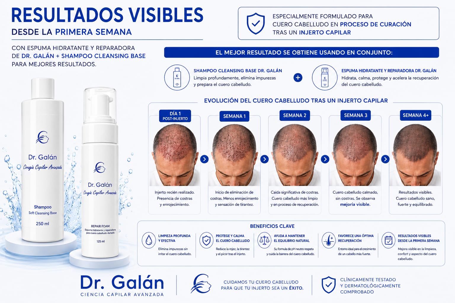 Pack Integral Postcirugía Capilar - Champú Post Injerto, Espuma Reparadora y Spray Calmante para Cuero Cabelludo Dañado - Tratamiento Completo