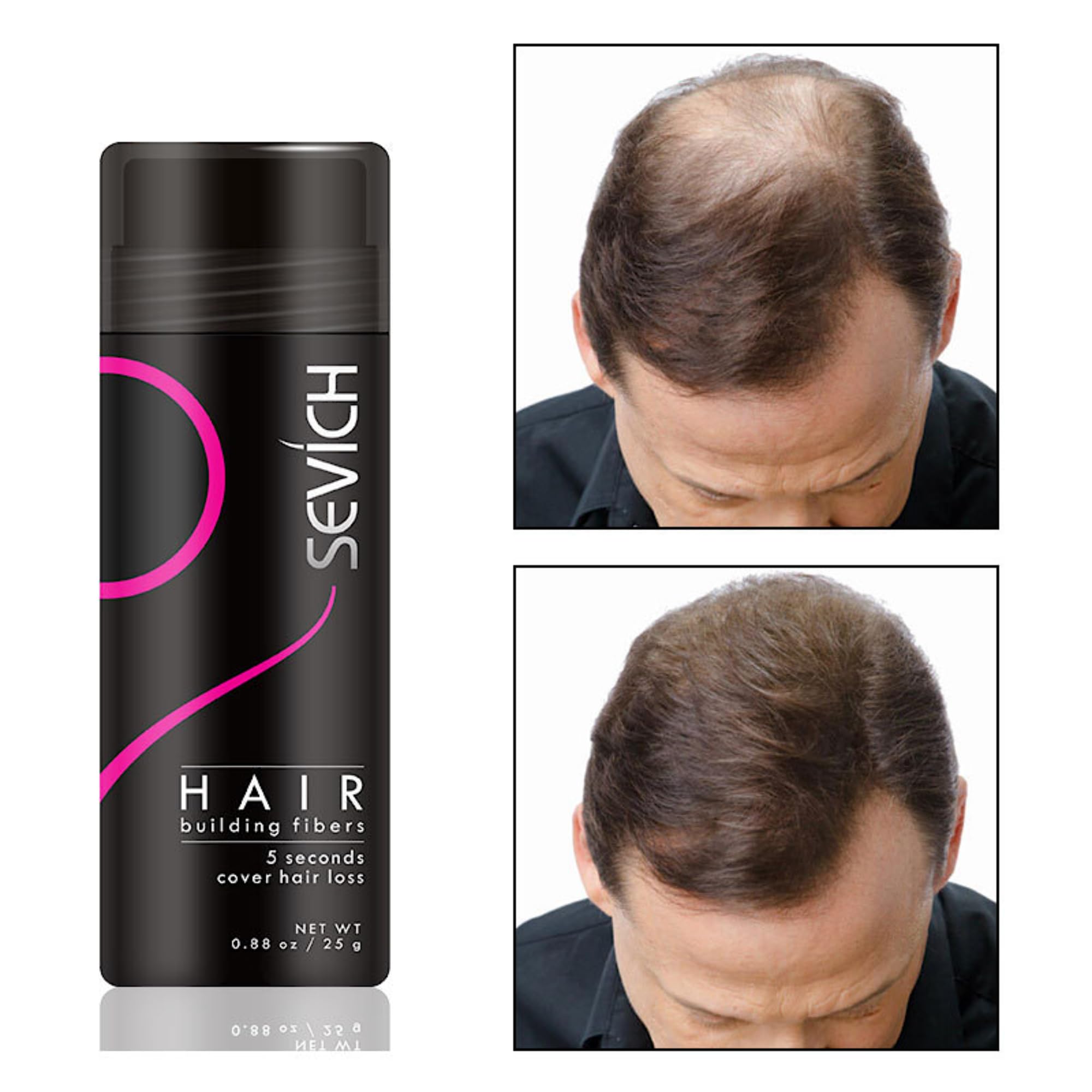 Sac de Recharge Fibre Capillaire Noir 100g - Cache le Perte de Cheveux - Poudre de Microfibre de Coton 100% Naturel pour Hommes et Femmes