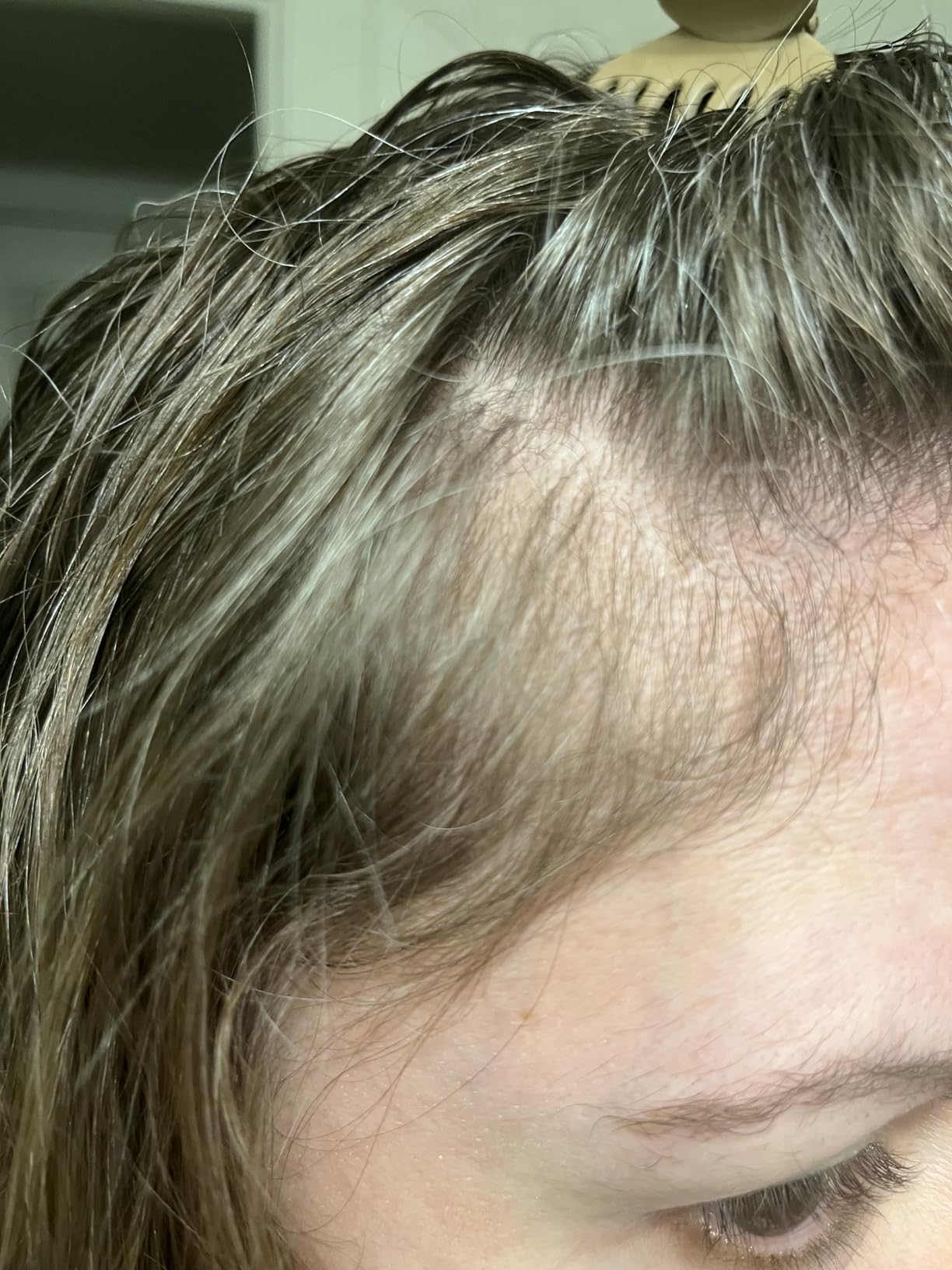 Good for minor thinning