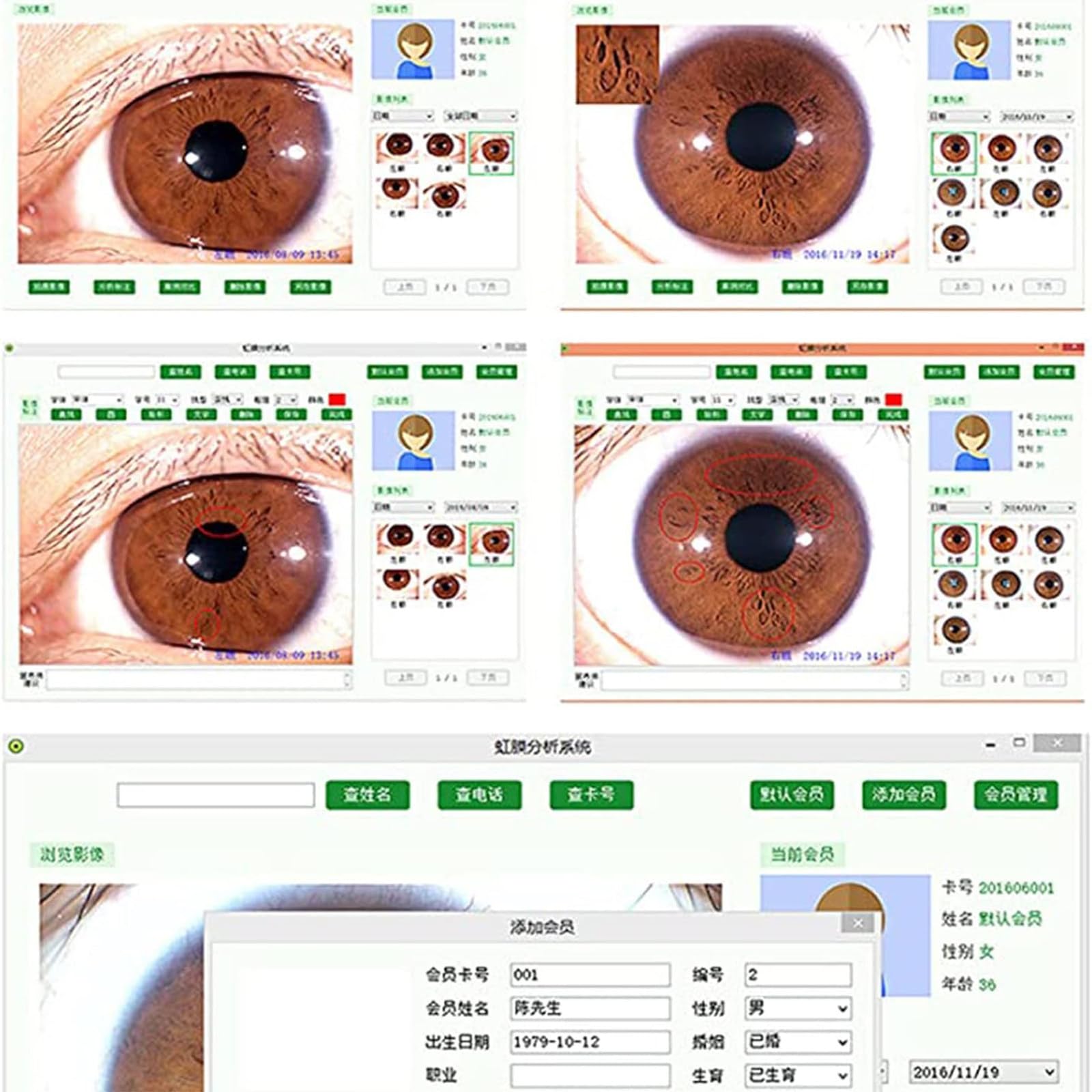 Analizador de Iris portátil Detector de Iris Cámara de iridología Computadora 2560 * 1920 Interfaz USB2.0 Cámara Ocular de diagnóstico de iriscopio con Software Pro Iris