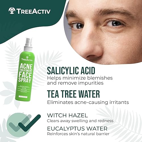 Miniatura 6 de Spray facial para tratamiento del acné, spray facial de 4 onzas líquidas con hamamelis, ácido salicílico para pieles propensas al acné y grasas,