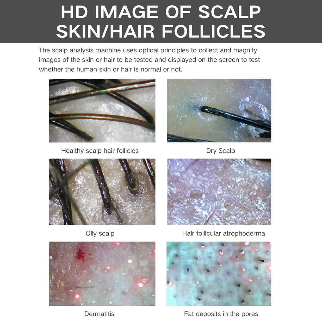 Analizzatore Diagnostico Pelle E Capelli,Microscopio Digitale 5 in 1,Rilevatore Di Capelli E Cuoio Capelluto,Tester Di Umidità E Olio Del Follicolo Pilifero per Analizzare I Problemi Cuoio Capelluto
