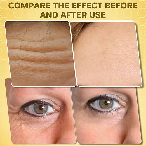 Miniatura 4 de BeeLift Crema reafirmante antienvejecimiento, 2025 nueva crema profesional reafirmante de piel de veneno de abeja reductora de arrugas, pasta