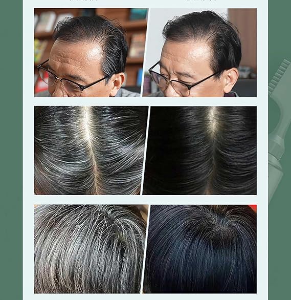 Fruit Essence Hair Dyeing Comb,Black Fruit Dyeing Cream,Plant Extract Hair Dye Essence,Hair Dye Cream With Comb (Black)