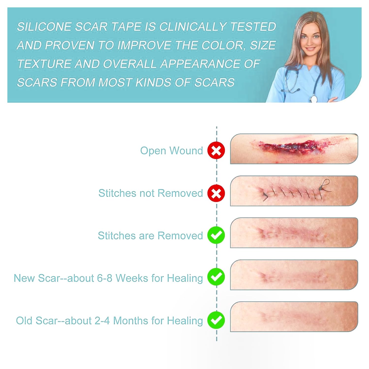 Silicone Scar Tape/Sheets for Surgical Scars, (1.6" x 59") Silicone Scar Removal Strips for Surgical, C-Section, Tummy Tuck, Keloid Scars Keloid Bump Removal (4cm x 1.5M)