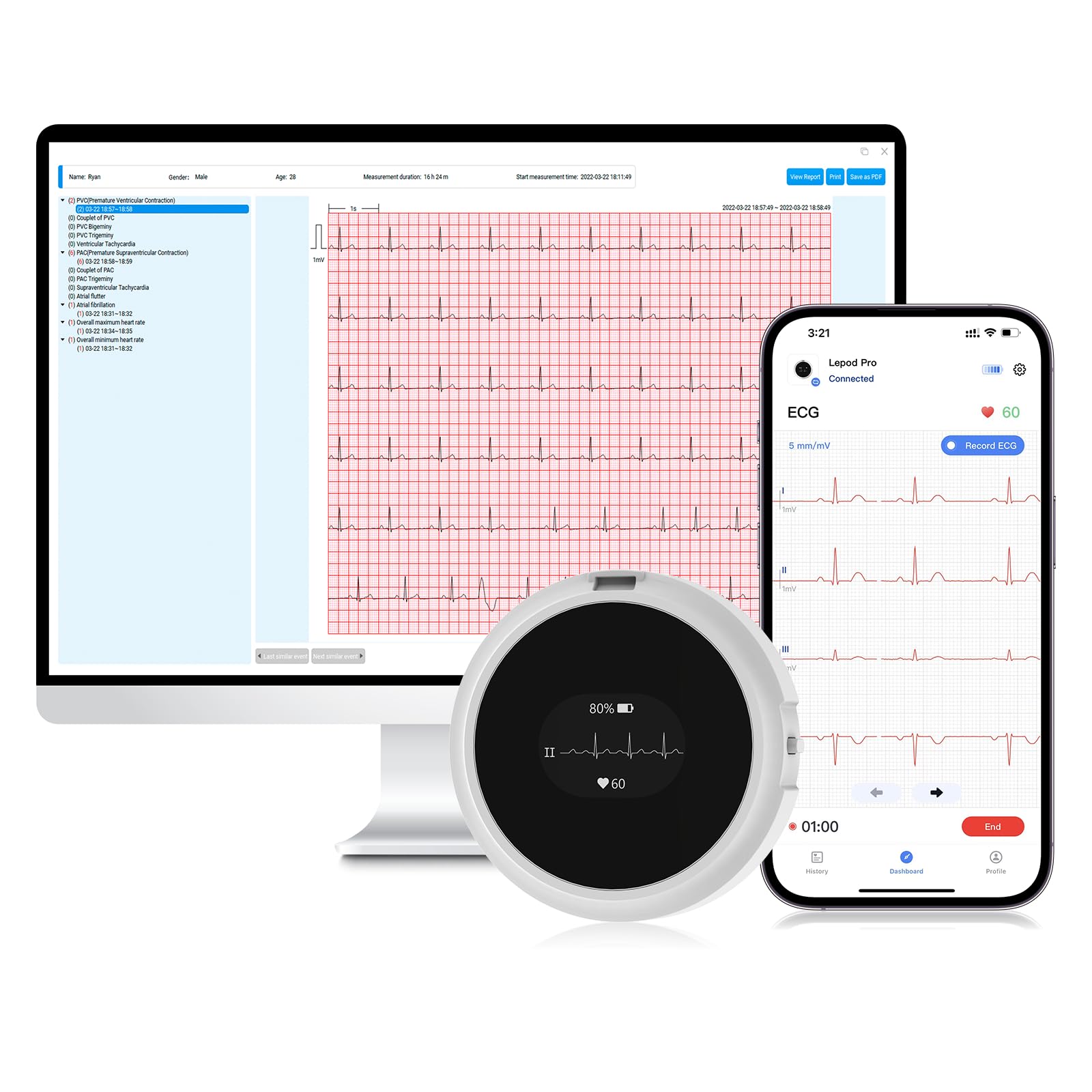 CheckMe LepodPro ECG portatile a 12 derivazioni con display OLED, registrazione ECG in tempo reale per 24 ore, marcatori di eventi, report ECG AI dettagliato, ricaricabile supporto per app mobili e PC