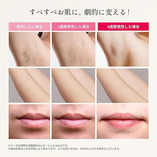 Miniatura 6 de Ulike IPL Laser Hair Removal Handset for Women and Men Sapphire AIR Recommended by Dermatologists Pain-free and Salon Results for Whole Body