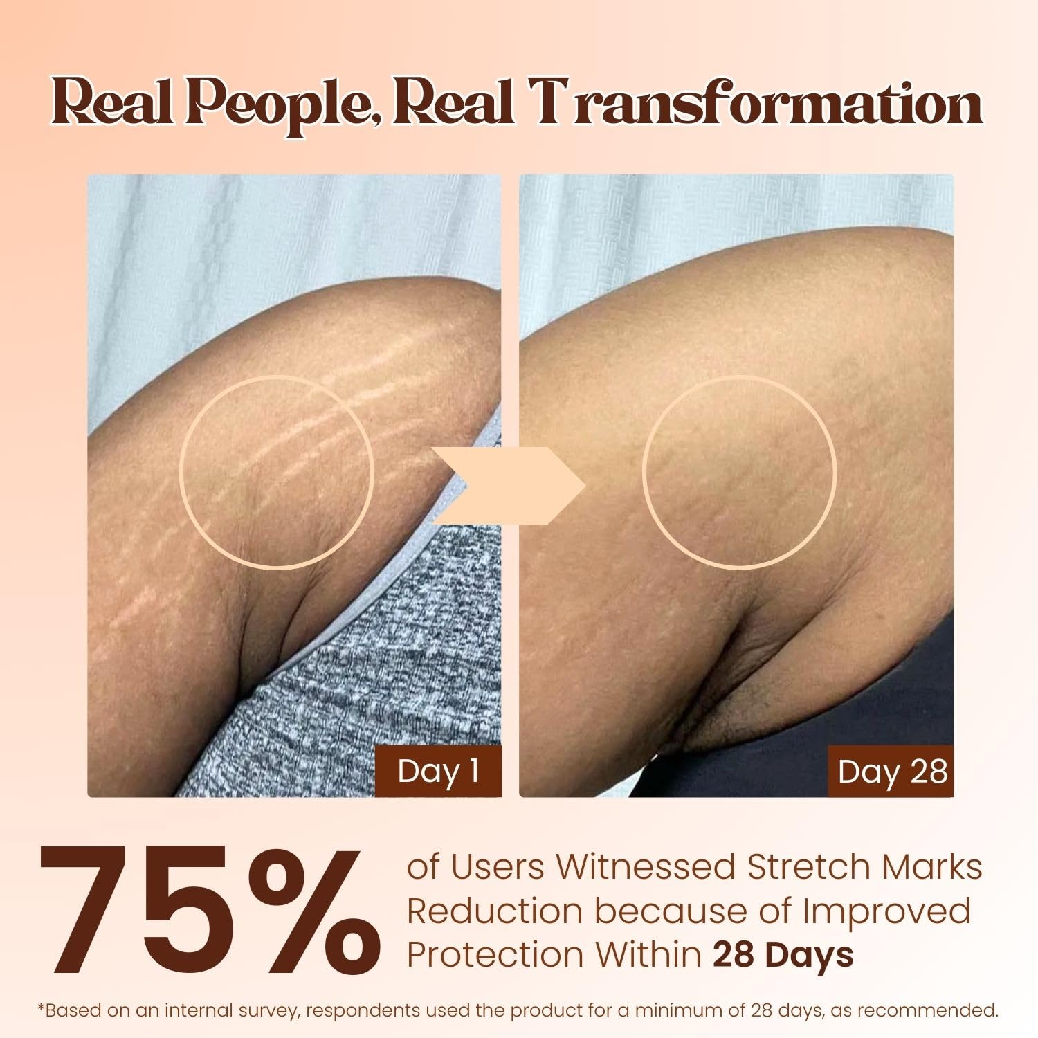POKONUT Stretch Marks Roll-On Serum for Pregnancy & After Delivery | Mulethi, Hyaluronic Acid & Rosehip Oil | Fades New & Old Stretch Marks & Scars | Dermatologically Tested | For Women & Men | 50ml 1