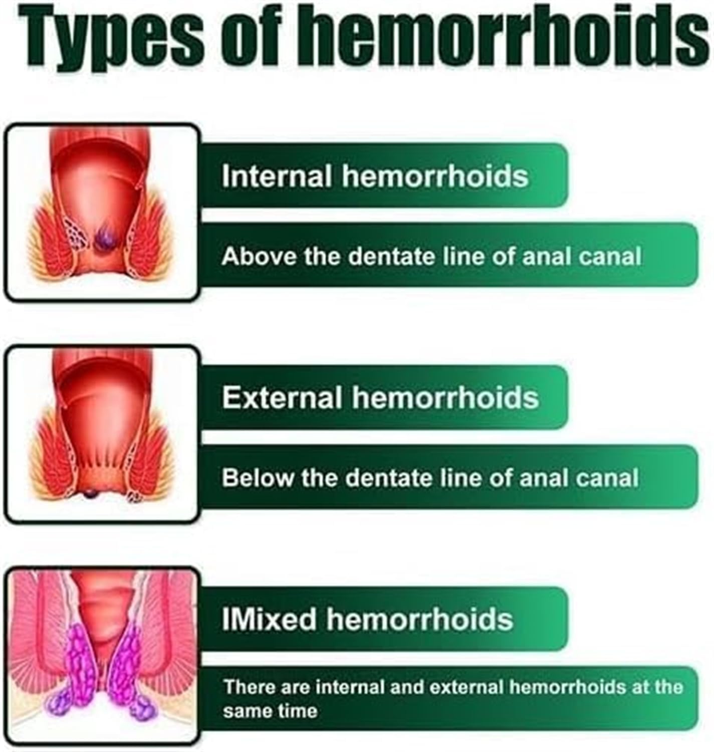 Crema Herbal para Hemorroides, Alivio Rápido de Picazón y Ardor Externos