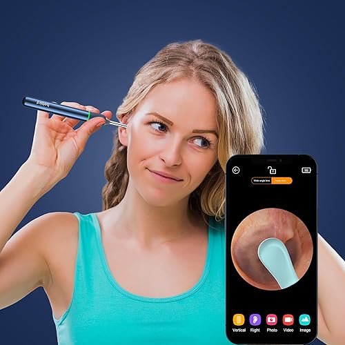 Miniatura 7 de BEBIRD Herramienta de eliminación de cera de oídos con cámara de oído, kit de limpiador de oídos con 2 modos de púa y pinzas, limpiador de oídos con