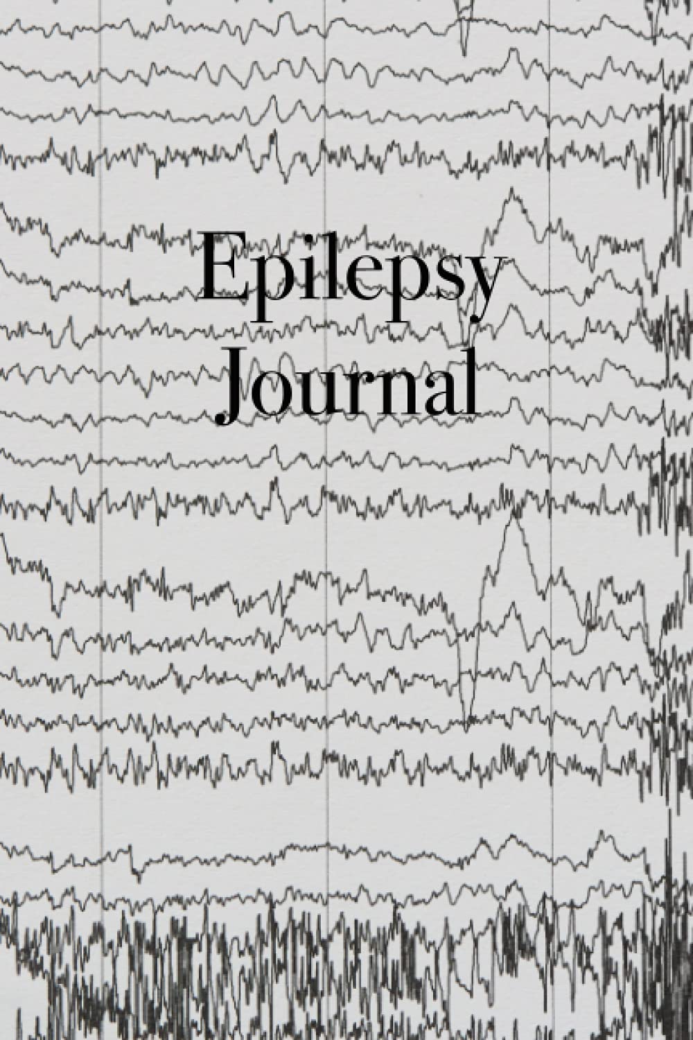 Epilepsy Journal: Detailed Epilepsy Journal for Adults, Children, and Infants - Easily Track Seizures, Seizure Triggers, Medication List, Calendar of Events, Seizure Log and Questions for Medical Team