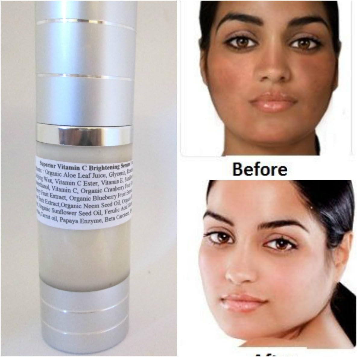 Vitamin C Serum for face,Hyaluronic acid,Carotone,Carrot oil,Beta Carotene,Papaya Ezyme,Vitamin C Serum 20%,Vitamin E,Ferulic Acid,Neem oil Kojic Acid Skin lightening serum for dark spots