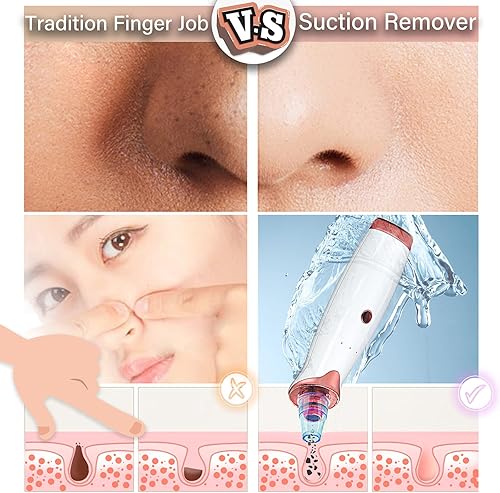 Miniatura 2 de Aspiradora de poros para eliminar puntos negros, limpiador eléctrico de poros faciales, acné, grasa, comedones y extractor de puntos blancos para