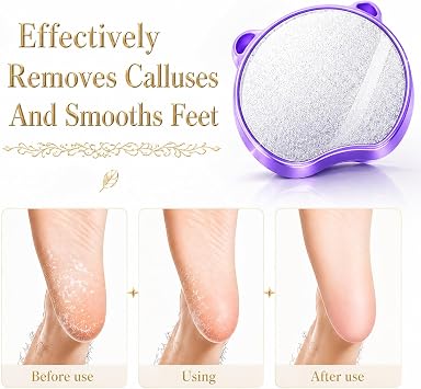 Bundle & Save: 4-Pack Magic Crystal Hair Remover - Painless Exfoliating Tool for Legs, Arms, Body | Men & Women (Assorted Colors)