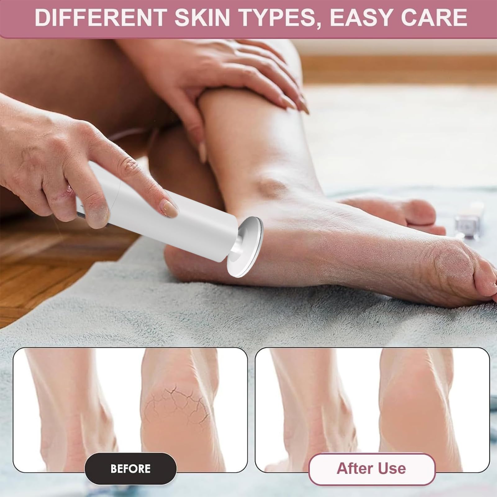 Callicida Eléctrico Exfoliador de Pies para Callosidades