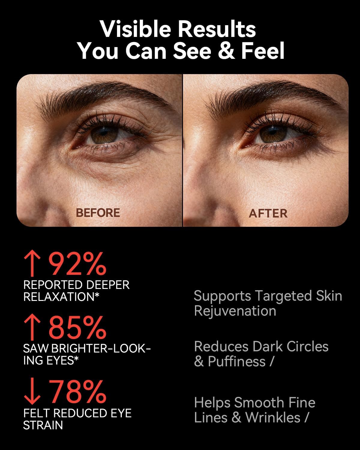 Red Light Therapy for Eyes– Heated LED Eye Mask, 4 Modes (Red, Blue, Infrared, Violet), 3 Brightness Levels & Timer | Eye Massager for Fatigue Relief, Dark Circles & Skincare (White) - Image 4