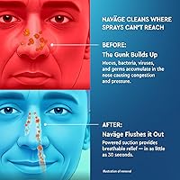 Vista 6 de Navage Essentials Bundle - Nasal Irrigation System - Saline Nasal Rinse Kit with 1 Navage Nose Cleaner, 30 Salt Pods and 1 Countertop Caddy