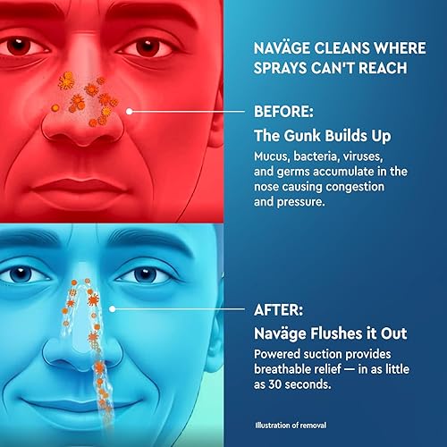 Miniatura 6 de Navage Essentials Bundle - Nasal Irrigation System - Saline Nasal Rinse Kit with 1 Navage Nose Cleaner, 30 Salt Pods and 1 Countertop Caddy