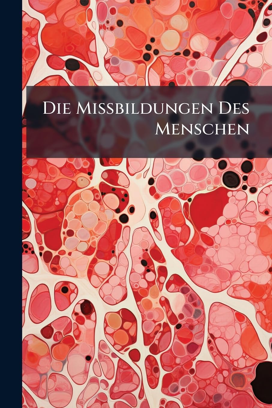 Die Missbildungen Des Menschen: Eine Systematische Darstellung Der Beim Menschen Angeboren Vorkommenden Missbildungen Und Erklärung Ihrer Entstehungsweise