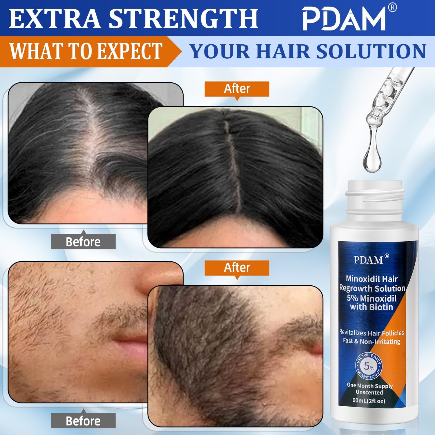 5% Minoxidil Hair Growth Serum for Men & Women – Regrow Fuller, Thicker Hair & Beard, Minoxidil for Women Hair Growth, Improves Appearance of Thinning Hair（3PACK）