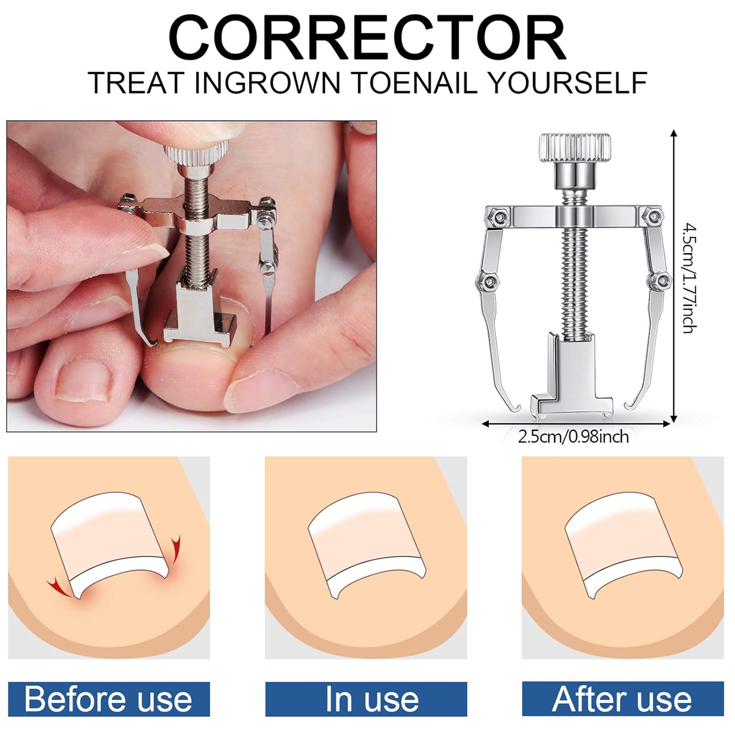 15 Pieces Ingrown Toenail Tools Stainless Steel Foot Nail Tools, Toenail File and Lifter, Nail Clipper, Cuticle Cutters, Cuticle Pusher and Manicure Pedicure Tools for Ingrown and Thick Nail (Red) : Beauty & Personal Care