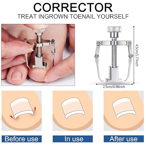 Miniatura 2 de 15 herramientas de uñas encarnadas de acero inoxidable, lima y levantador de uñas, cortaúñas, cortadores de cutículas, empujador de cutículas y