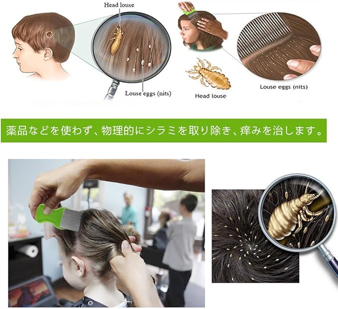 Amazon シラミ専用櫛 アタマジラミ用くし ステンレス製 卵駆除専用櫛 しらみ退治コーム シラミ撃退用ブラシ 子供も使える グリーン Karui 櫛 コーム 通販