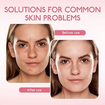5Pcs Collagen Face Mask Hydrogel Overnight Sheet Mask for Face,Moisturising Face Masks Skincare with Collagen,Deep Hydrating Jelly Mask for Pores,Self Care Gifts for Women