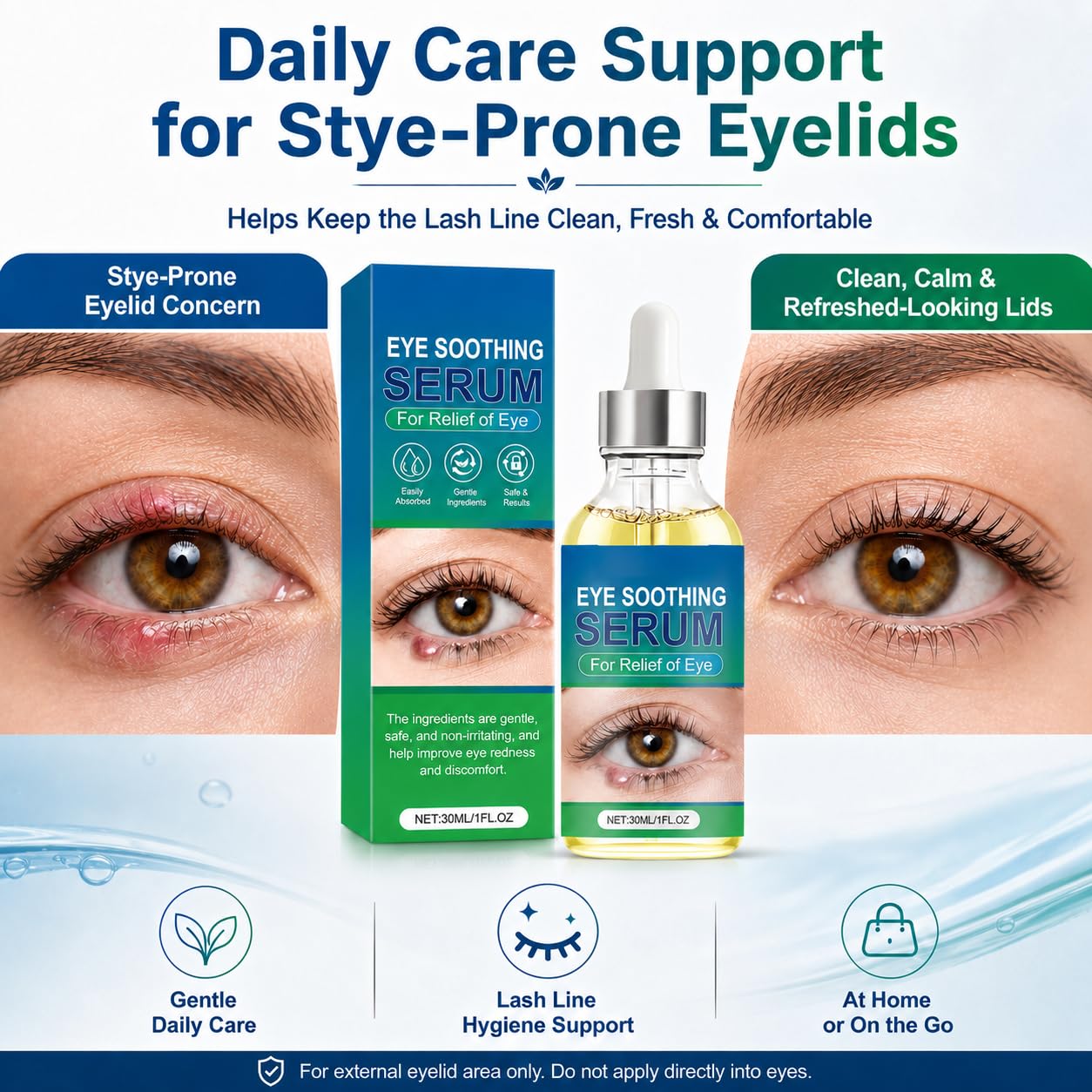 Stye Eye Relief Serum, Natural Eyelid Care for Styes,Chalazion & Blepharitis, Blepharitis Relief for Redness, Puffiness, Swelling & Irritation, 1.01 Fl Oz