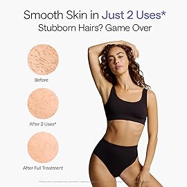 Ulike Laser Hair Removal Device Air 10 Ipl Gift for Women and Men, Ice Cool and Permanent Hair Reduction for Nearly Painless, Dual Lights, Skin Sensor & USHR Mode Hair Removal in 10mins from Home