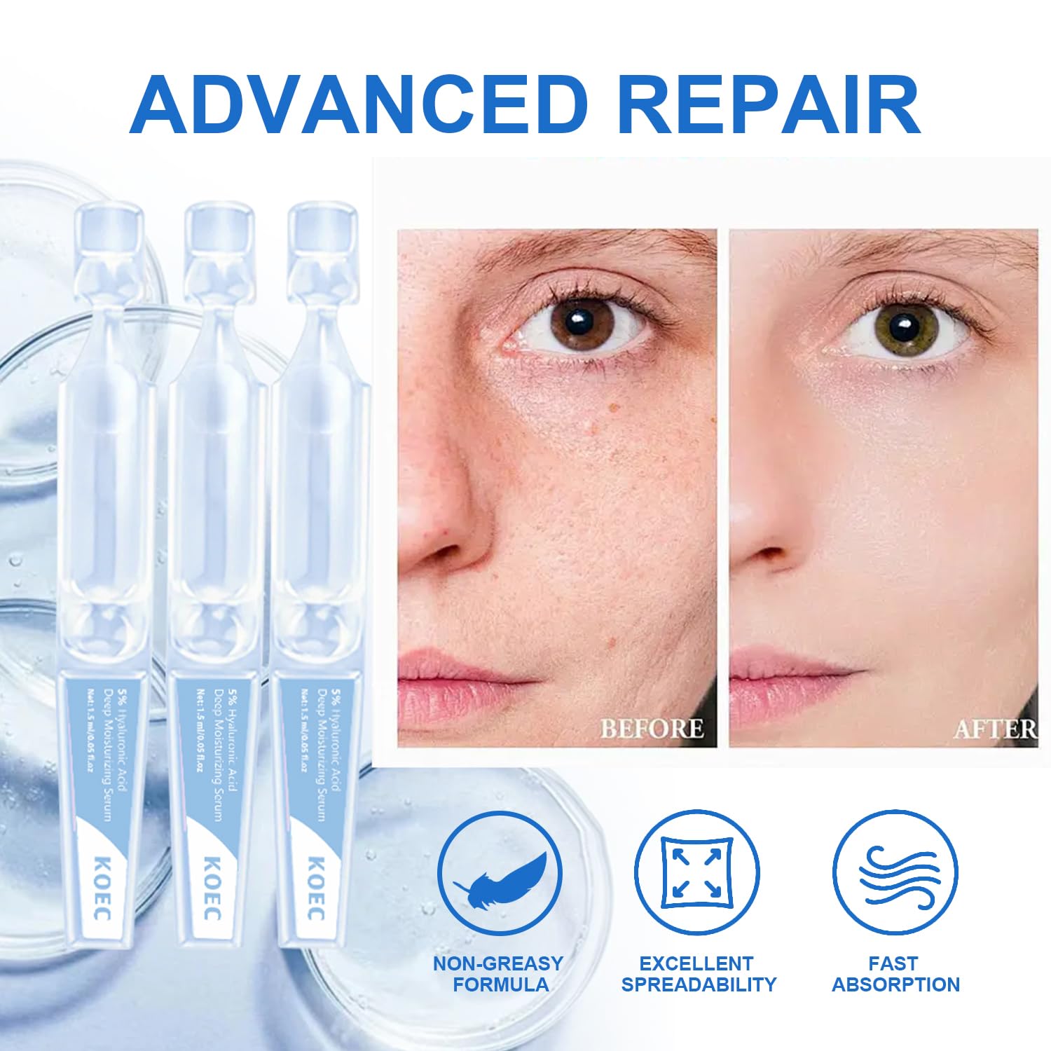 Amazon.com: 5% Hyaluronic Acid Serum Ultra-Moisturizing Vials