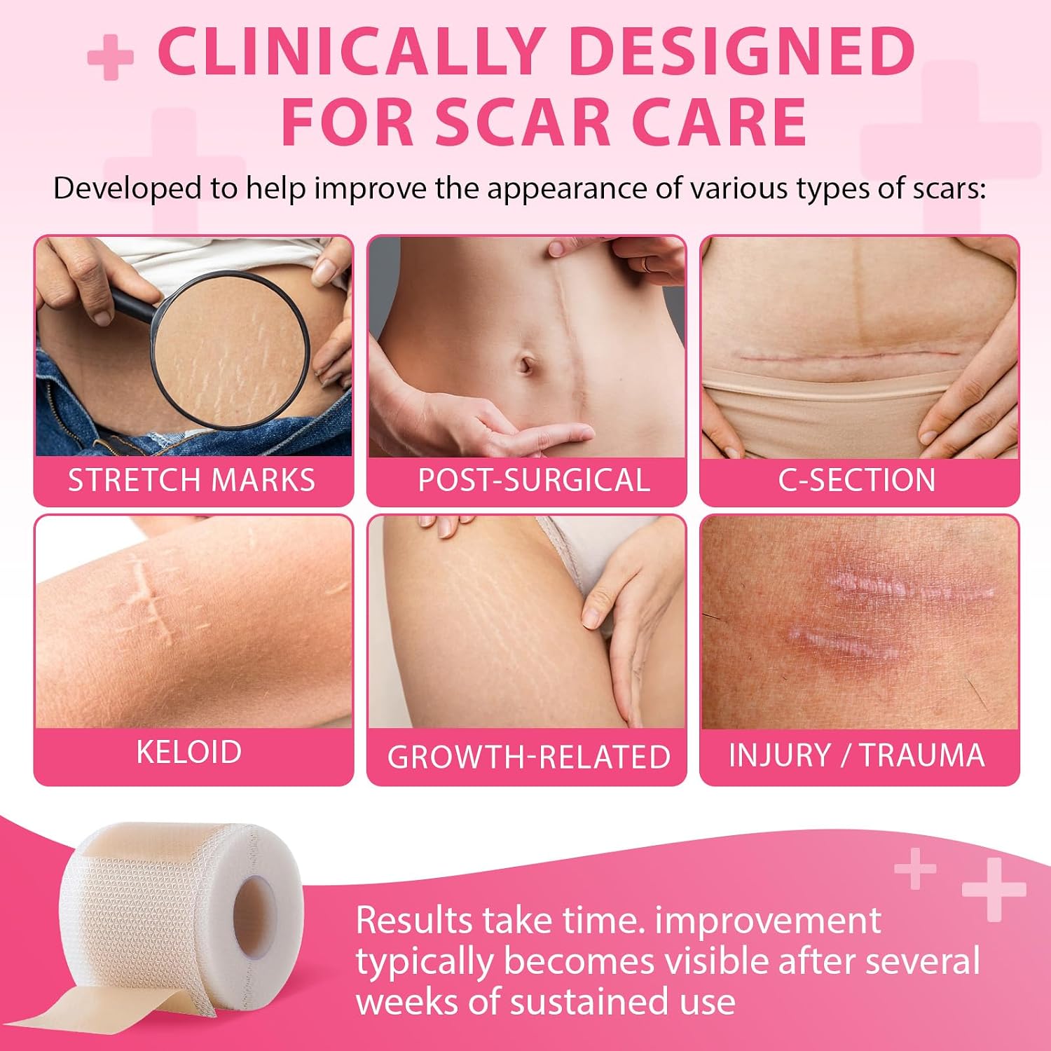 Silicone Scar Sheets,Silicone Scar Tape 1.6'' x 120'',Reusable Professional Silicone Scar Sheet for Surgical Scars,Tummy Tuck, Keloid, Burn, Acne,C-Section