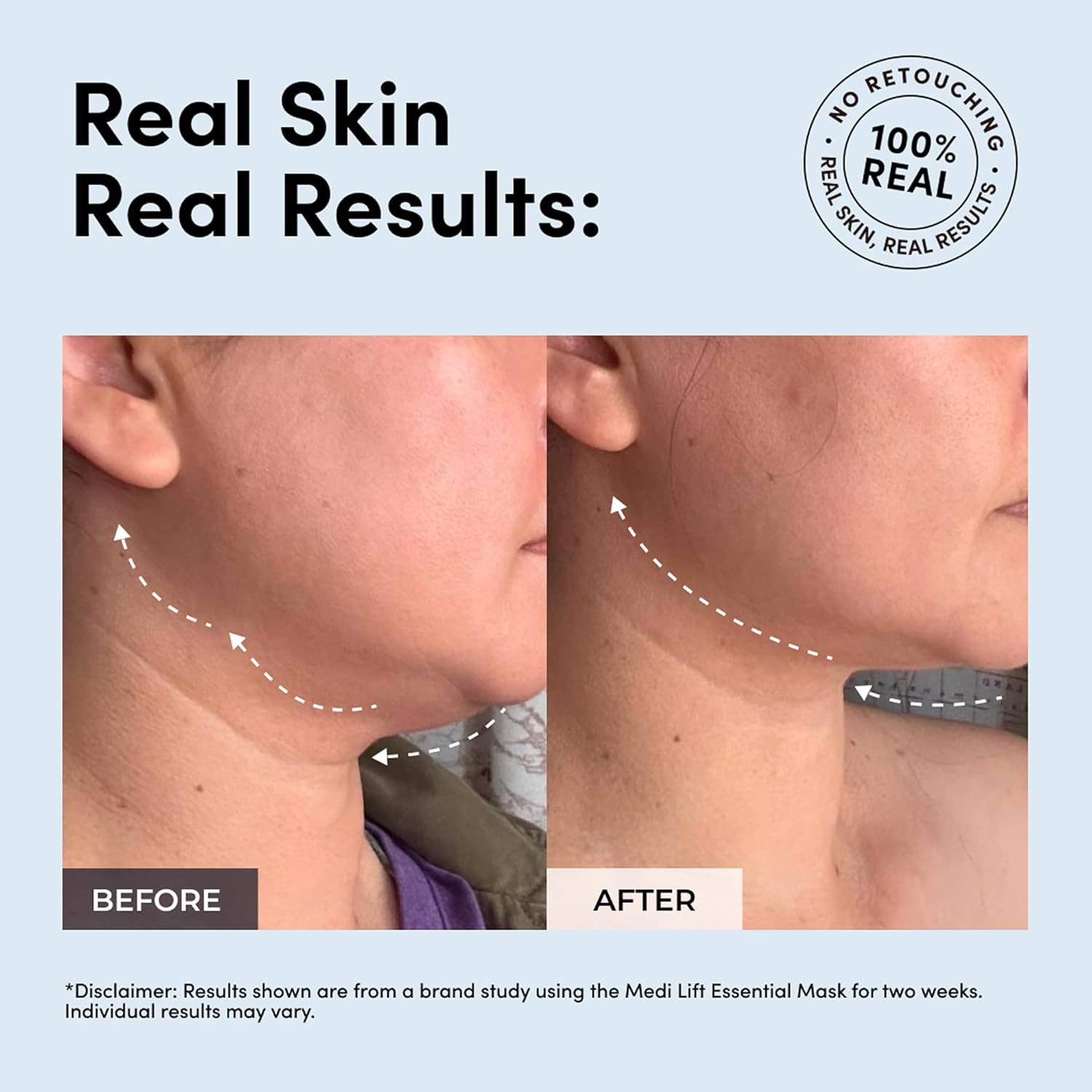 Essential Mask - Medi Lift EMS Facial Toning Device, FDA Cleared, Hands-Free Skin Device - Image 5