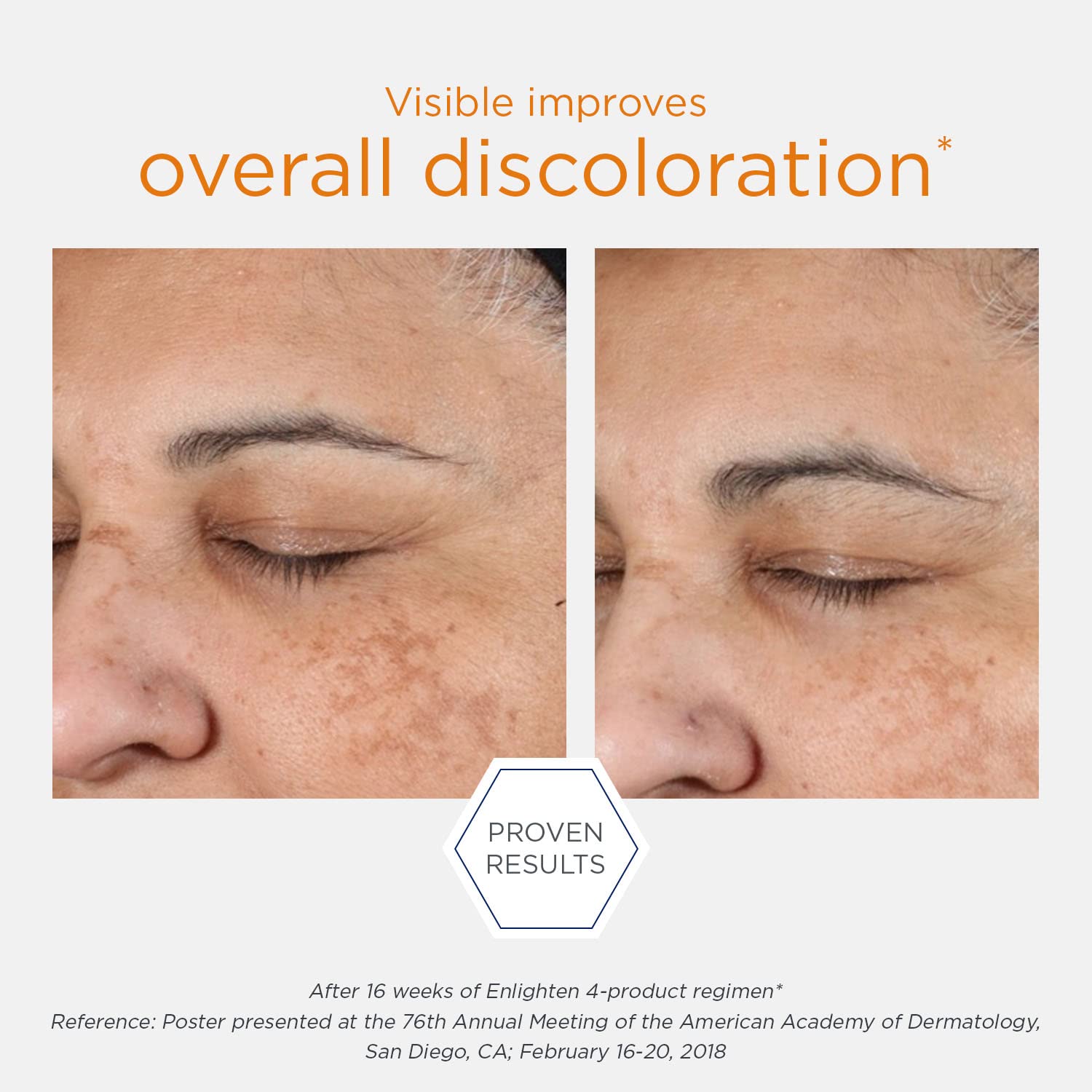 NEOSTRATA Enlighten Brightening Serums for Uneven Tone