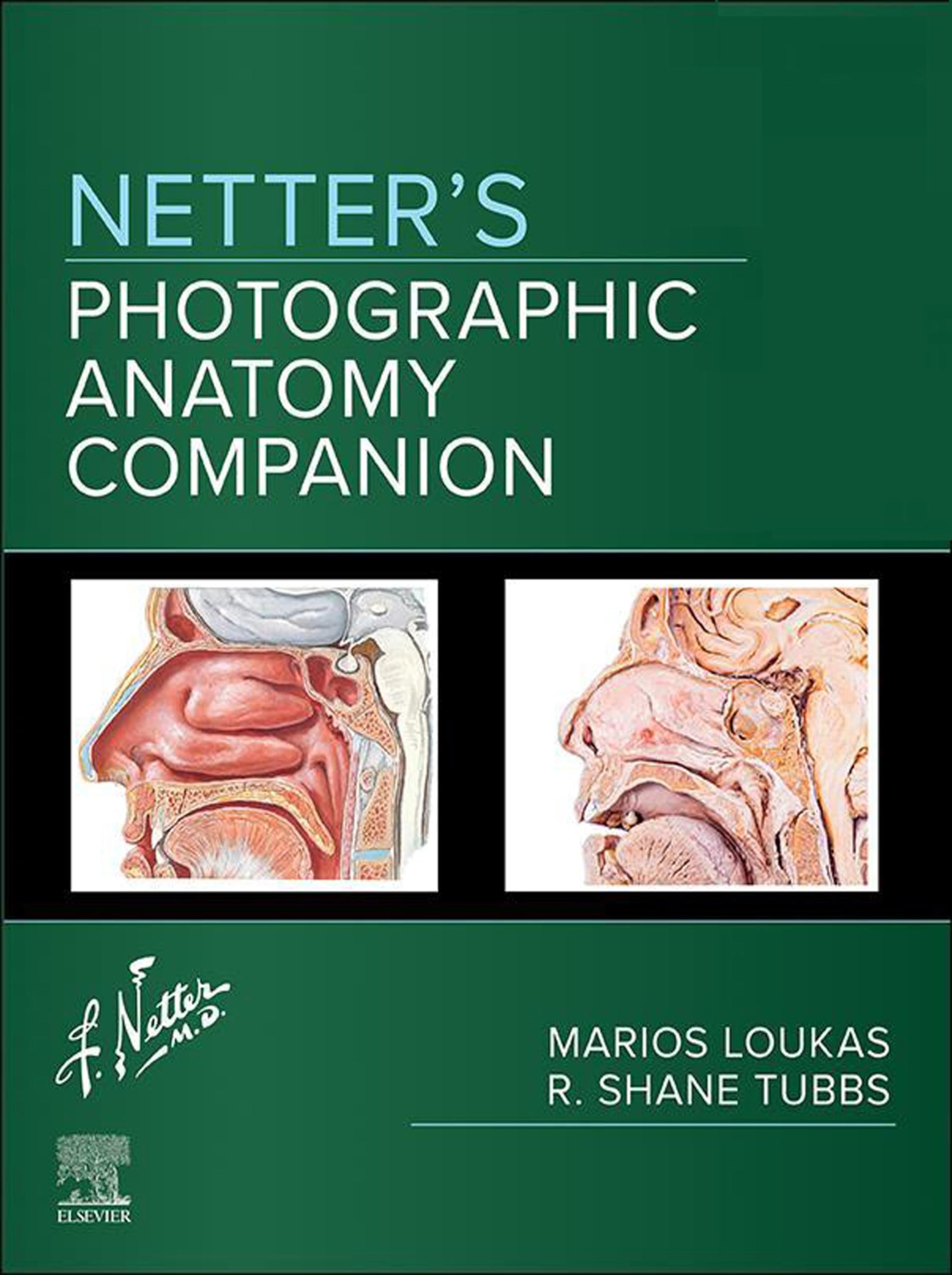 Netter's Photographic Anatomy Companion - E-Book (Netter Basic Science)