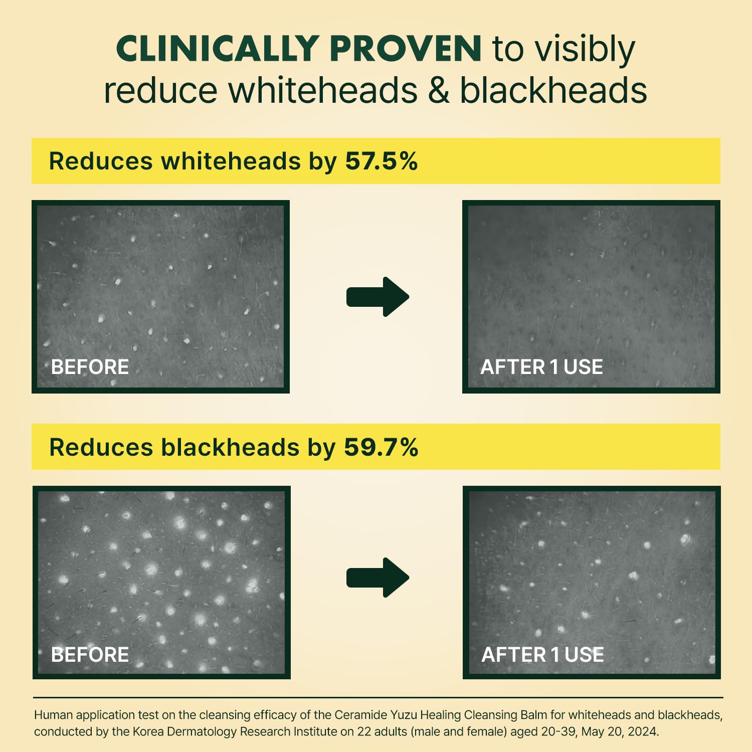 Ceramide Yuja Makeup Cleansing Balm with Travel Size | Deep Cleansing All-in-One Korean Face Cleanser, Makeup Remover, Zero Irritation, Blackheads Remover, Clean Beauty, Vegan (135g / 4.76oz) - Image 7