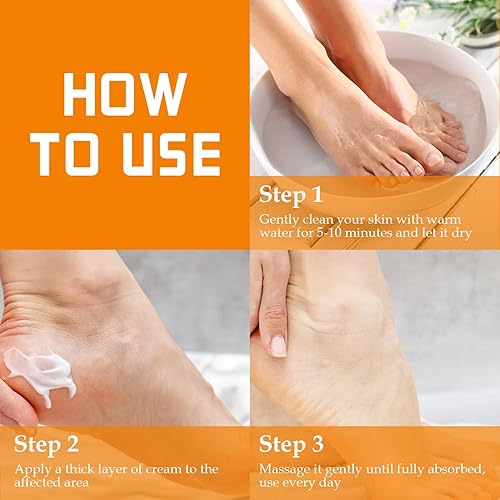 Miniatura 6 de YOUNGYOUNGLOVE Crema de urea 60% sin fragancia más 2% ácido salicílico, para manos secas agrietadas, rodillas, pies, talones, crema de pies sin