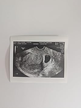 Prank 2D Customized Fake Ultrasound Single Photo ONLY NO Gender