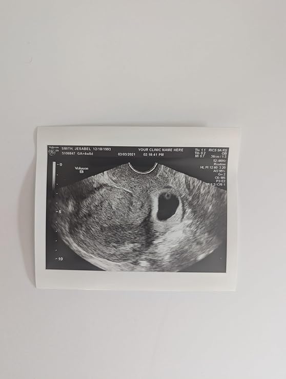 Prank 2D Customized Fake Ultrasound Single Photo ONLY NO Gender